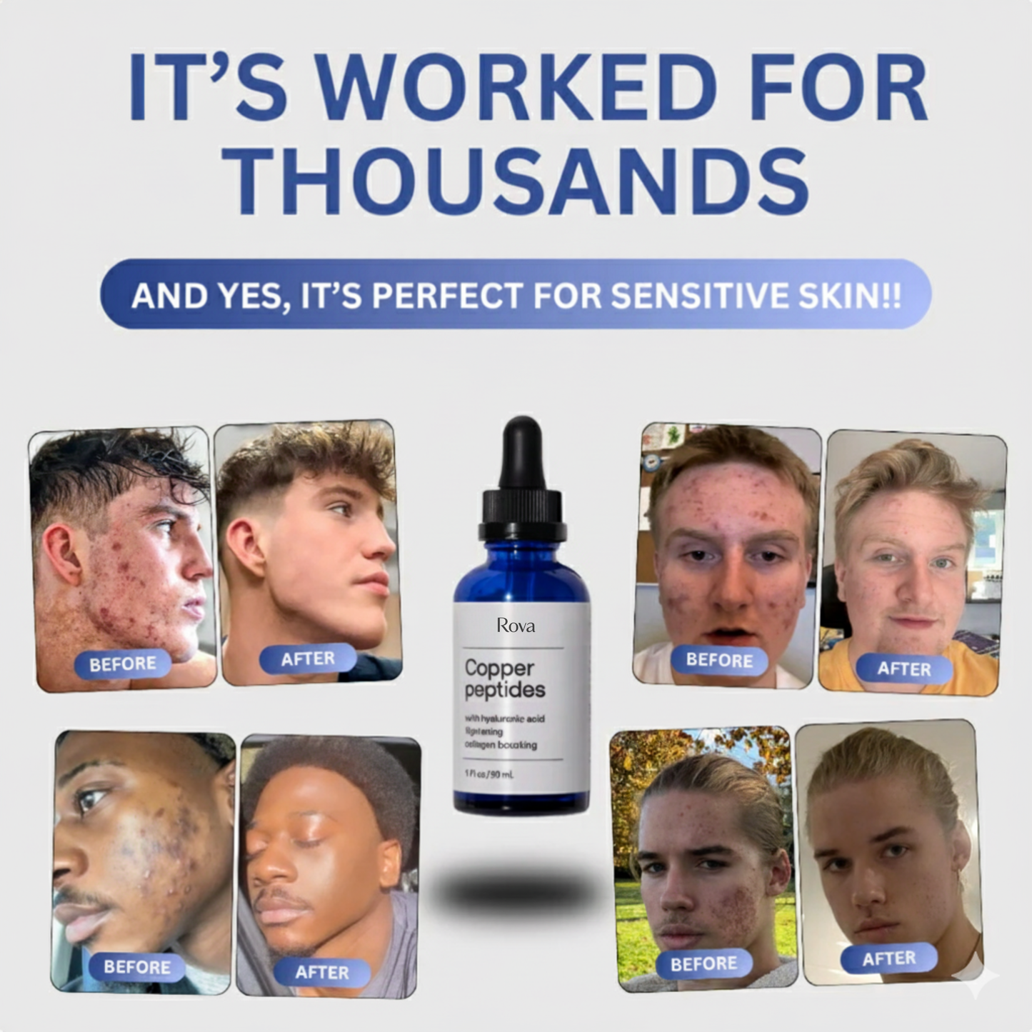 GHK-Cu Peptides Serum