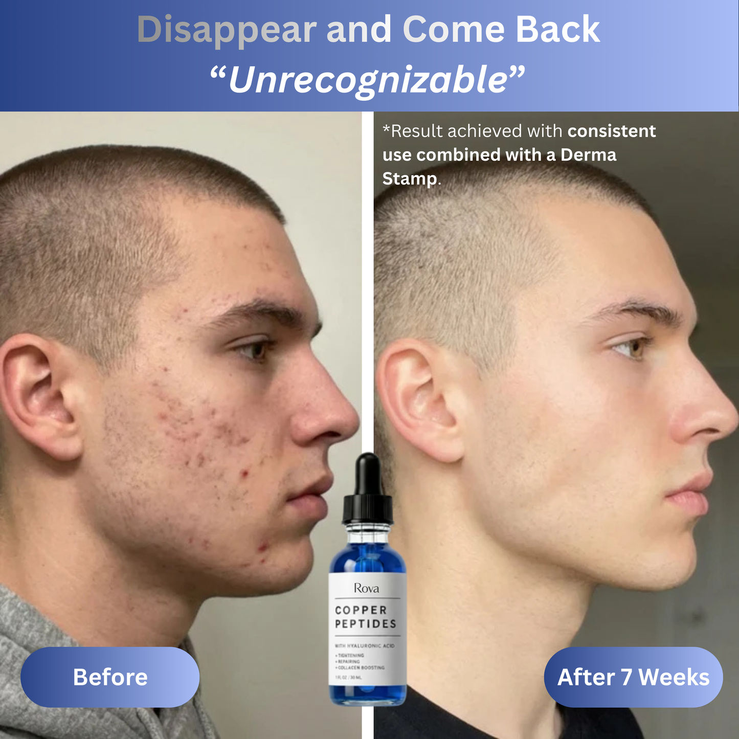 GHK-Cu Peptides Serum