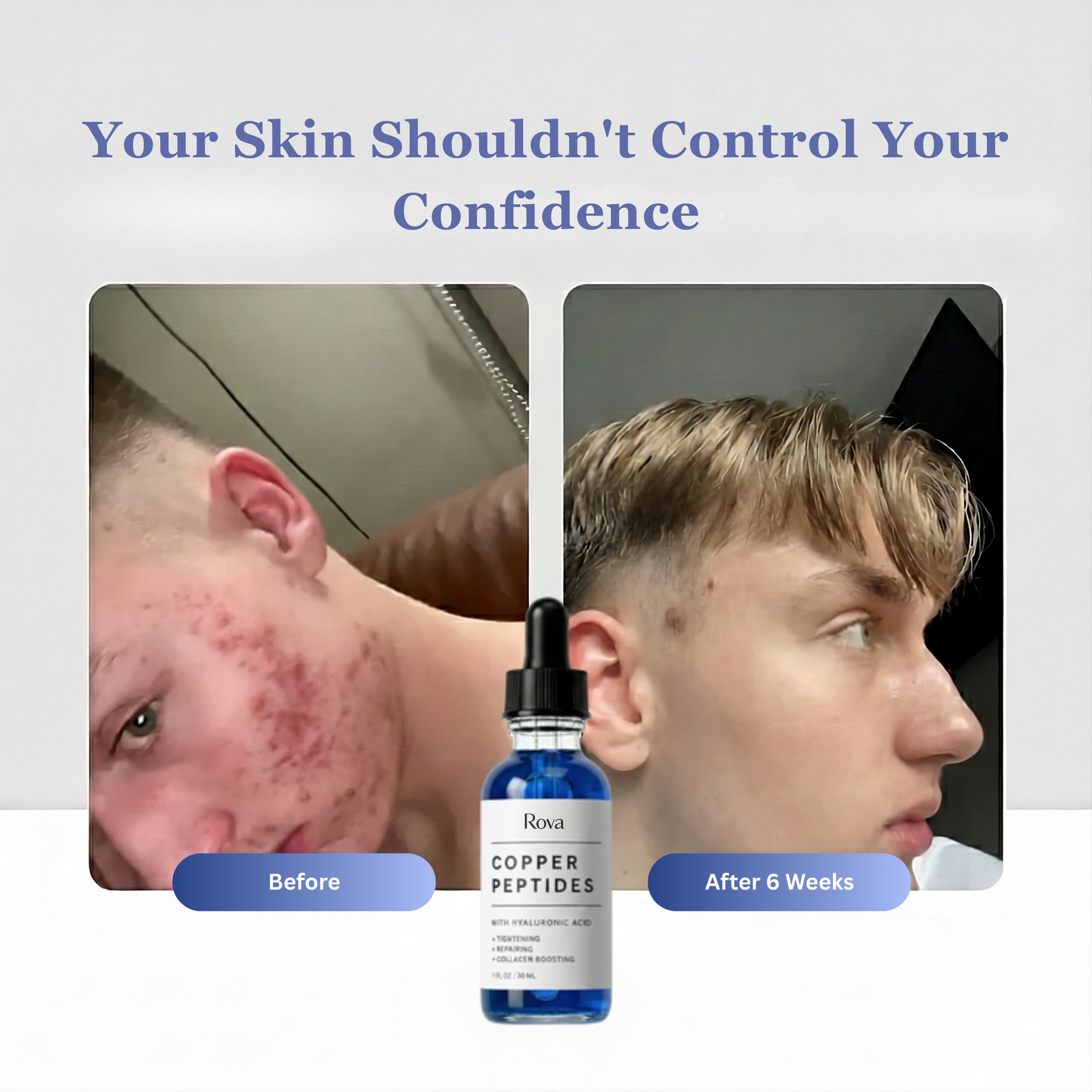 GHK-Cu Peptides Serum